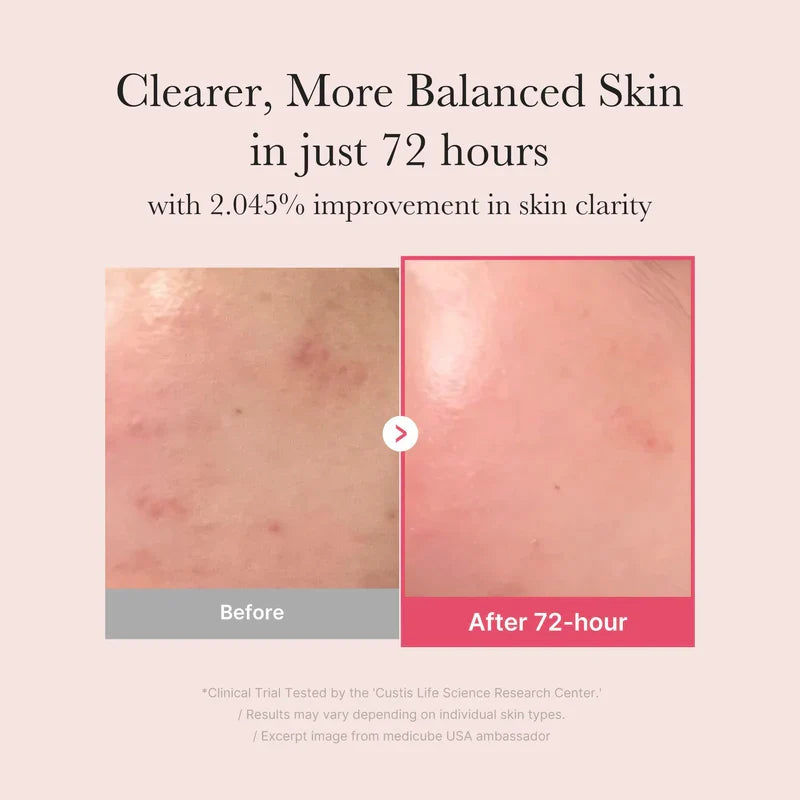 Medicube TXA Niacinamide 15 Serum Glow Crush Beauty