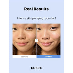 COSRX Hyaluronic Acid Hydra Power Serum - 100ml Glow Crush Beauty