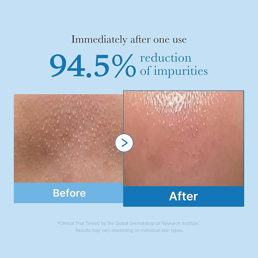 Medicube Zero Pore Blackhead Cleansing Oil Glow Crush Beauty