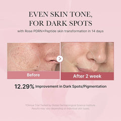medicube PDRN Pink Peptide Toner I Pink Glow Toner for Skin Boosting, Soothing and Calming, Uneven Skin Tone, Rose PDRN & Peptide & Niacinamide, Korean Skin Care (250ml) Glow Crush Beauty