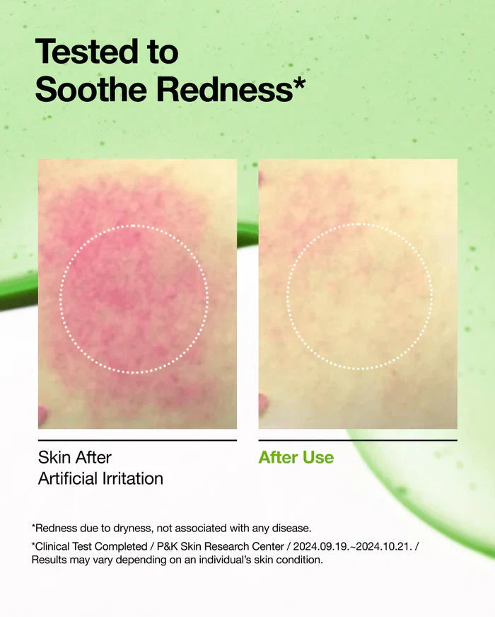 Anua Azelaic Acid 10 Hyaluron Redness Soothing Serum Glow Crush Beauty