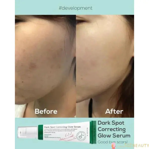 AXIS-Y Dark Spot Correcting Glow Serum Glow Crush Beauty
