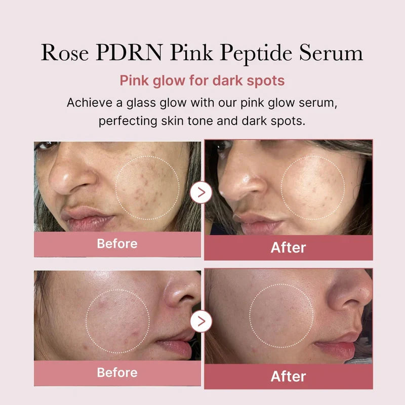 Medicube PDRN Pink Peptide Serum Glow Crush Beauty