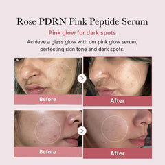 Medicube PDRN Pink Peptide Serum Glow Crush Beauty