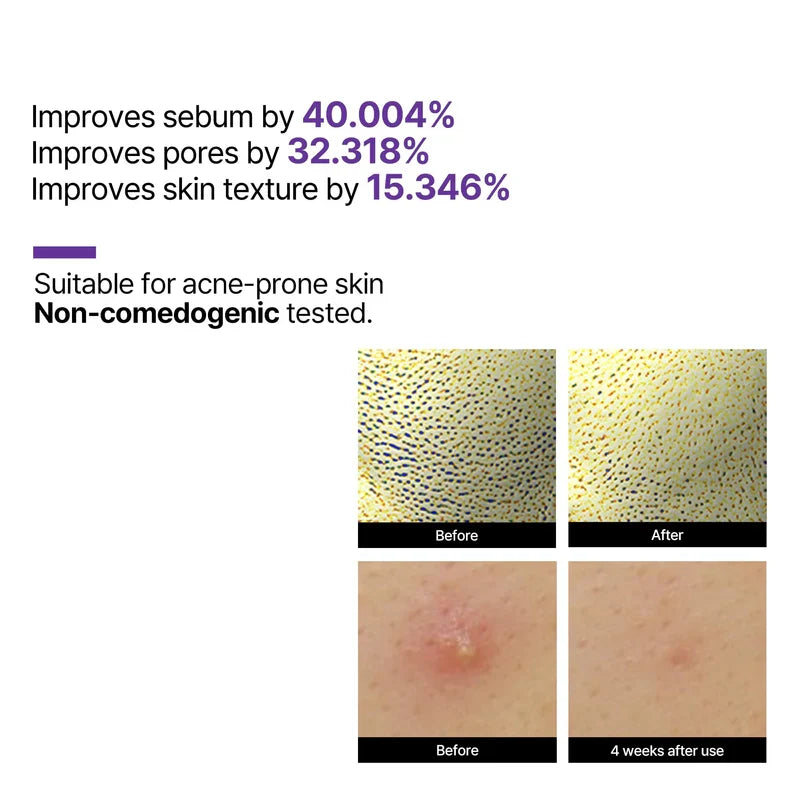 SOME BY MI Retinol Intense Reactivating Serum 30ml Glow Crush Beauty