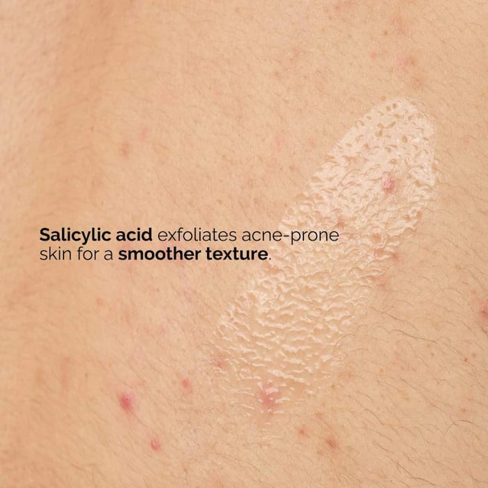 The Ordinary Salicylic Acid 0.5% Body Serum Glow Crush Beauty