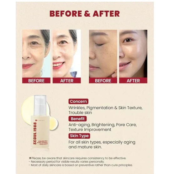 SEOUL 1988 Eye Cream – Retinal Liposome 4% + Fermented Bean Glow Crush Beauty